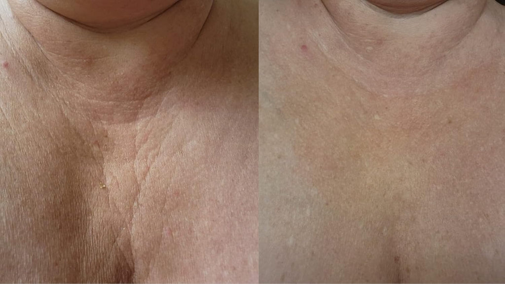 Hyaluronic Rejuvenating Serum for Face & Body 3.34 oz