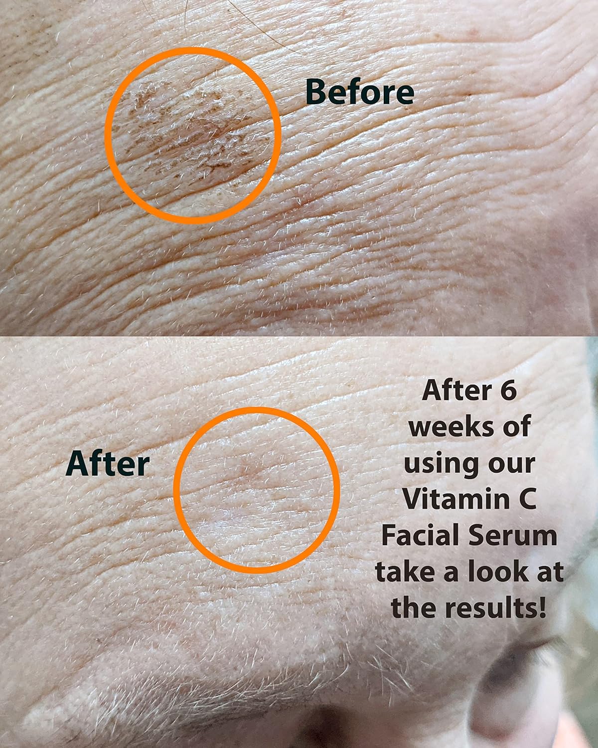 VITAMIN C Serum 1 oz. Anti-Aging Skin Brightener